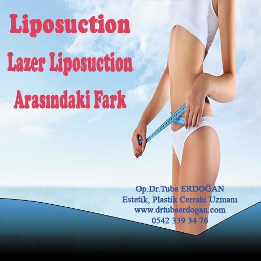 Liposuction ile Lazer Liposuction Arasındaki Fark.