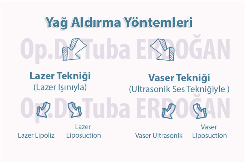 Yağ Aldırma Yöntemleri Arasındaki Fark